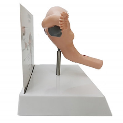 Фото: Анатомическая модель матки с патологиями Corpo ventre-2 Анатомическая модель матки с патологиями Corpo ventre-2